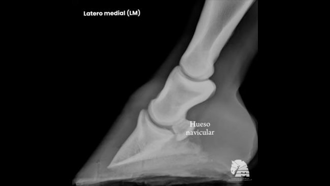 Placa radiografía de casco latero – medial | AMMVEE Placa radiografía de casco latero - medial | AMMVEE